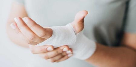 چند باور غلط درباره سوختگی‌