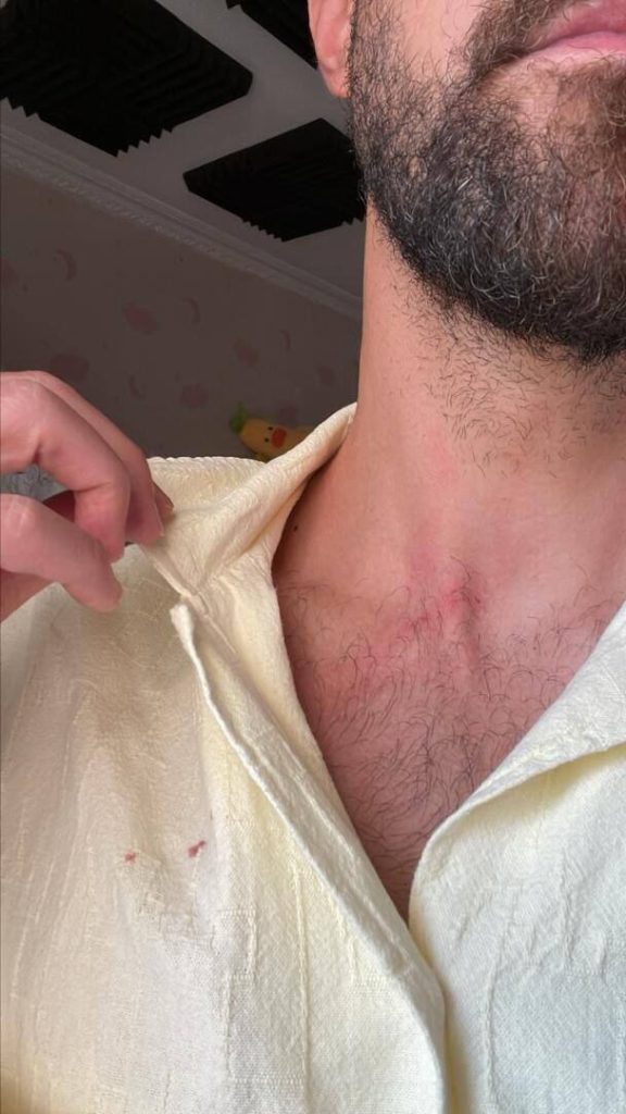 حمله سارقان به مهاجم سابق استقلال در اتوبان چمران تهران + عکس