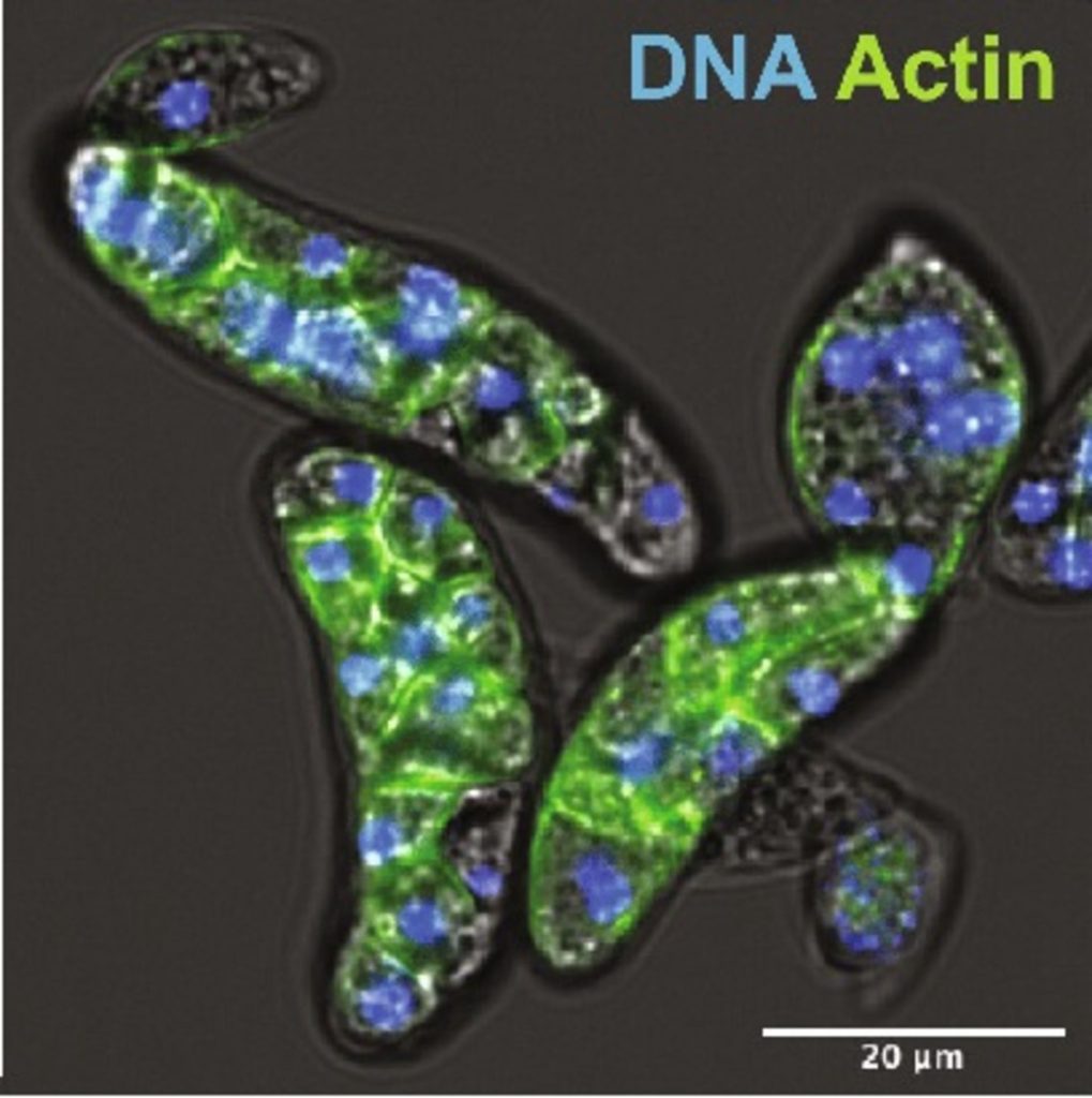 Amoebidium appalachense رنگ‌آمیزی شده با فالویدین همراه DNA (آبی)