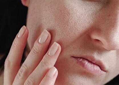 کمبود چه ویتامین‌هایی سبب خشکی پوست صورت می‌شود؟